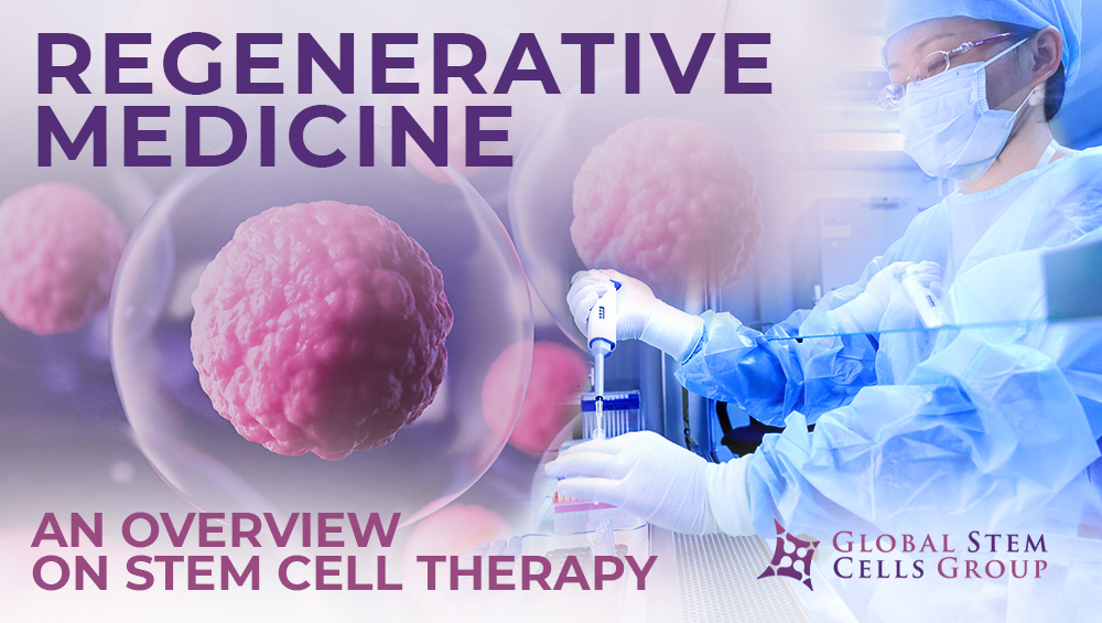 Regenerative Medicine An Overview On Stem Cell Therapy Global Stem Cells Group