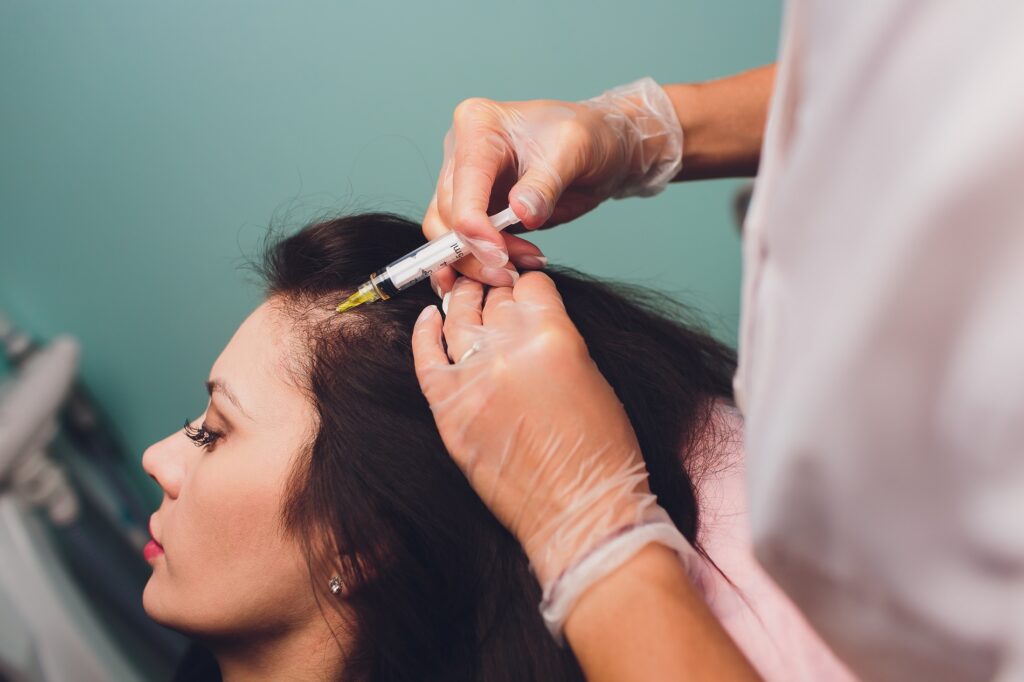 PRP and stem cell treatments being studied for hair loss