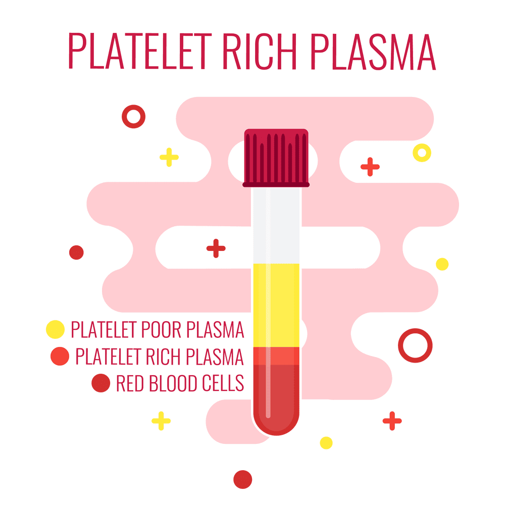 Platelet-Rich Plasma Injections: Protocol Guide